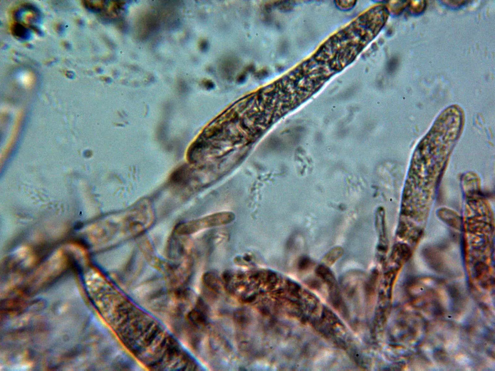 Microscopía de Russula torulosa - 10 - Pileocistidios 3